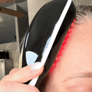 UltraHair™ Terapia Para el Crecimiento de tu Cabello