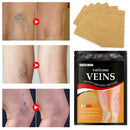 Varicose™ Parches Herbales Para Piernas Cansadas (2x1)