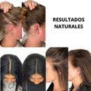 UltraHair™ Terapia Para el Crecimiento de tu Cabello